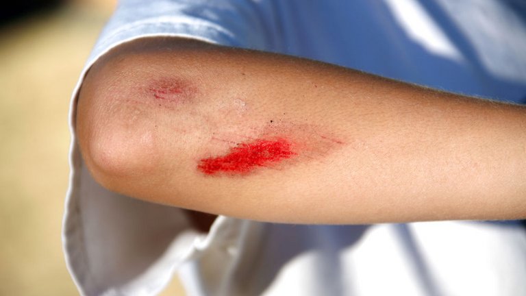 Undgå faldulykker i dit hjem