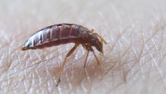 Sådan undgår du væggelus i boligen